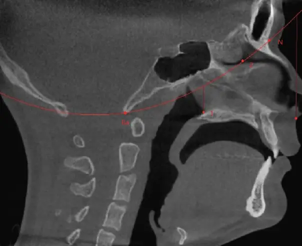 Evaluación de ortodoncia para niños en Tribeca Dental Studio 4 Kids
