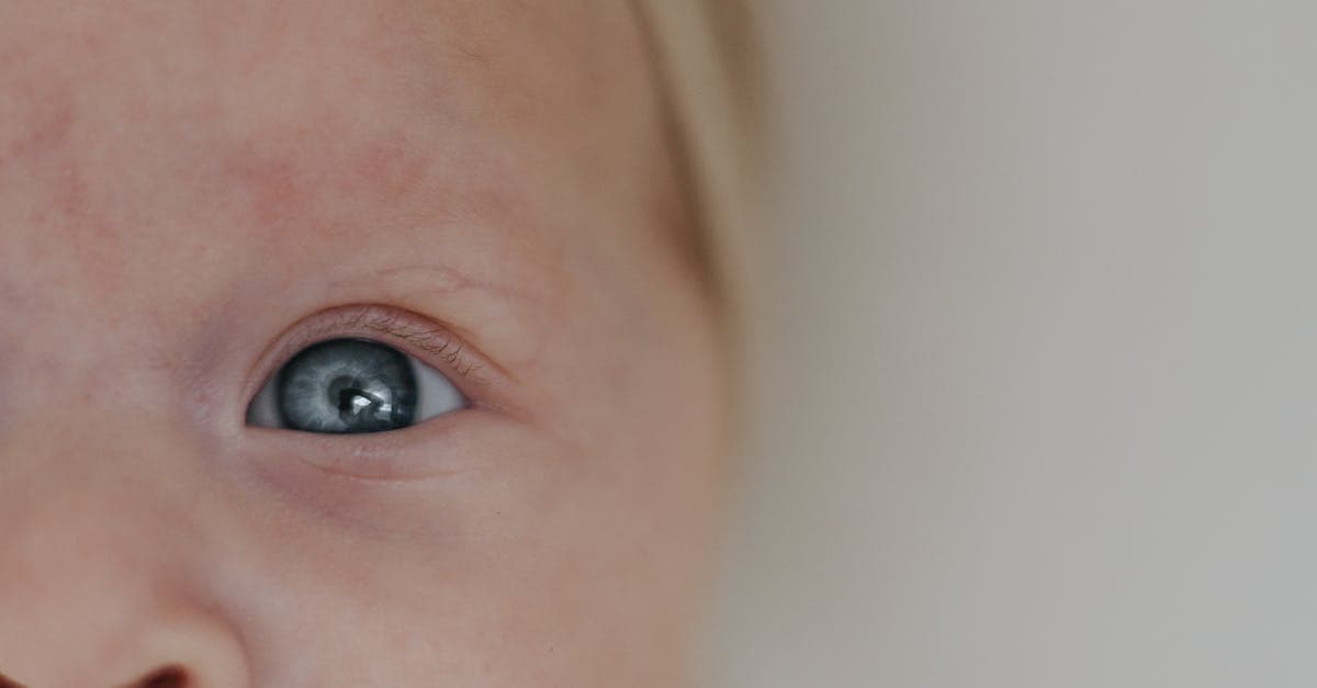 What Parents Should Know About Laser Frenectomies for Tongue-Tie in Babies and Children in Manhattan